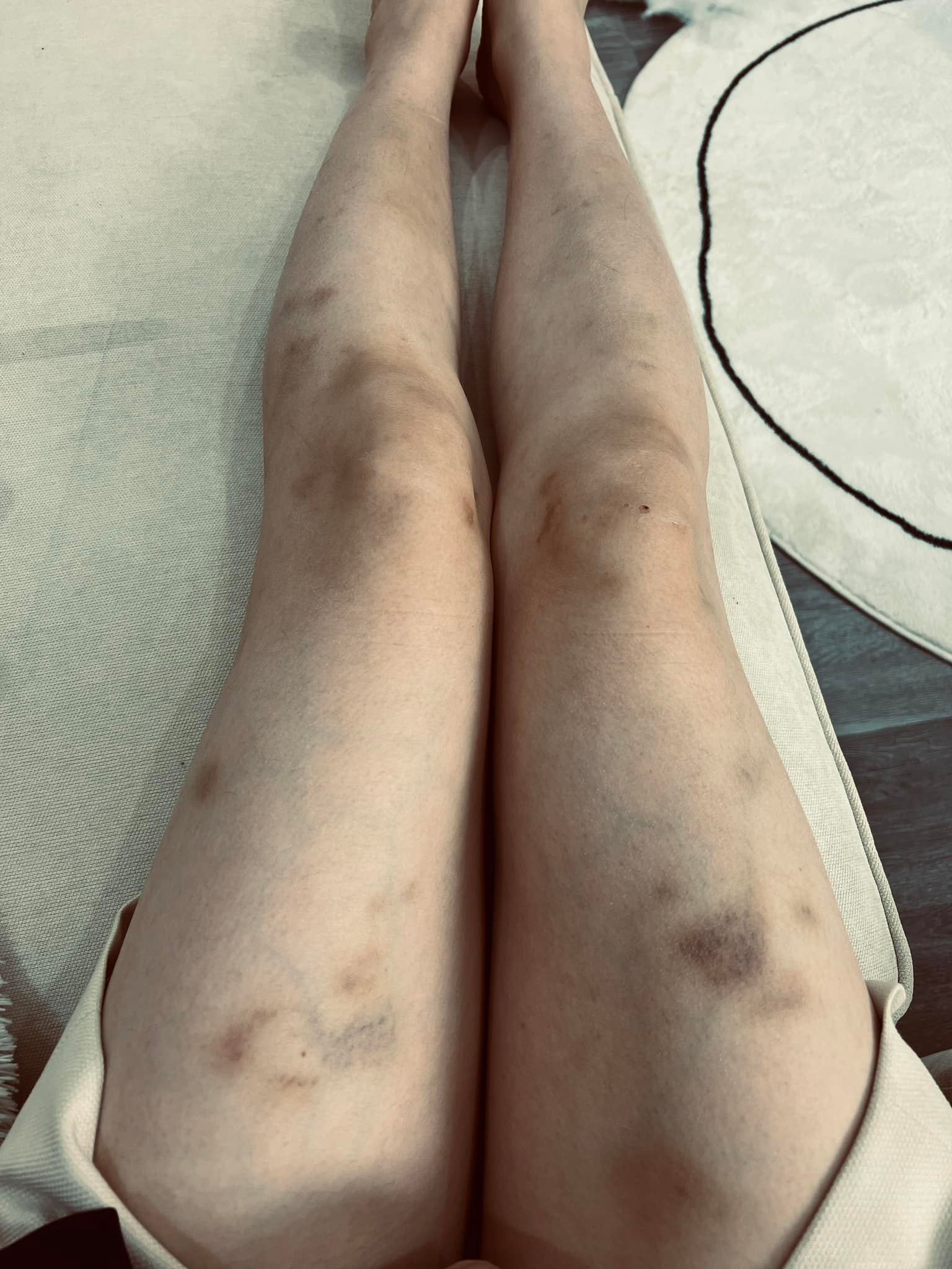 Giành giải nhất 