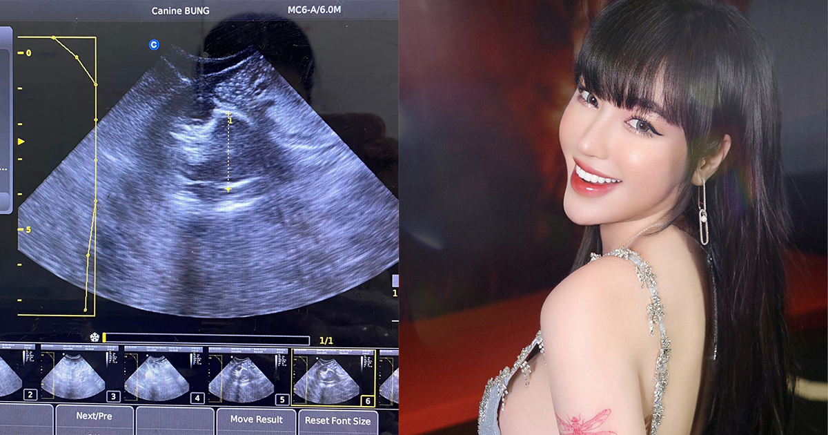 Elly Trần phủ nhận mang bầu lần 3, ảnh siêu âm thai là của mèo cưng