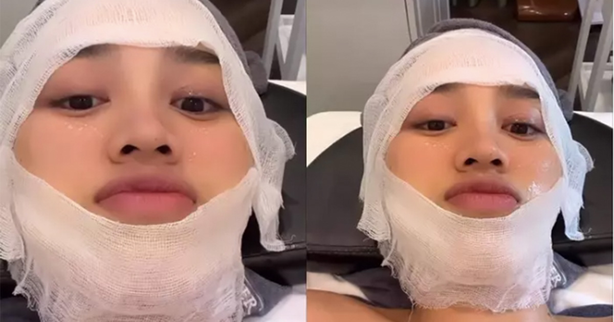 Đỗ Thị Hà băng bó khắp mặt, chuyện gì đây?