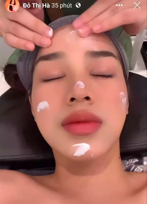 Đỗ Thị Hà bất ngờ chia sẻ hình ảnh băng bó khắp mặt, chuyện gì đây? - Ảnh 1