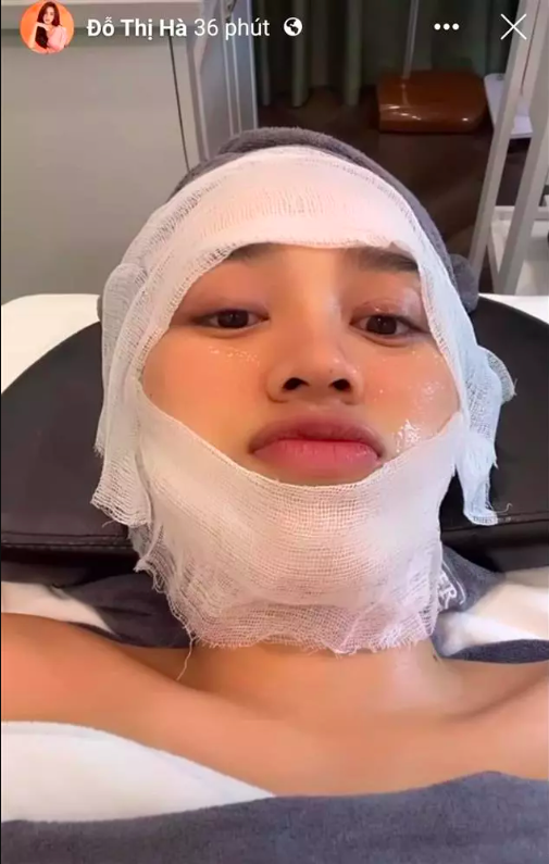 Đỗ Thị Hà bất ngờ chia sẻ hình ảnh băng bó khắp mặt, chuyện gì đây? - Ảnh 3