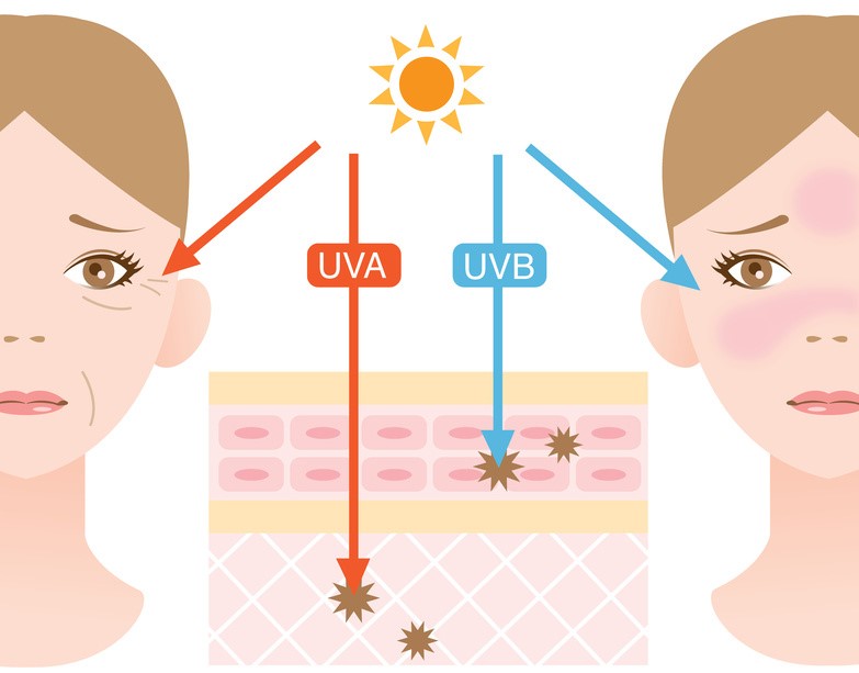 Các tia UV từ Mặt Trời gây tổn thương da và để lại hắc tố.