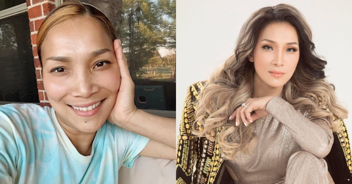 Nhan sắc ca sĩ Hồng Ngọc sau 1 năm bị tai nạn bỏng mặt