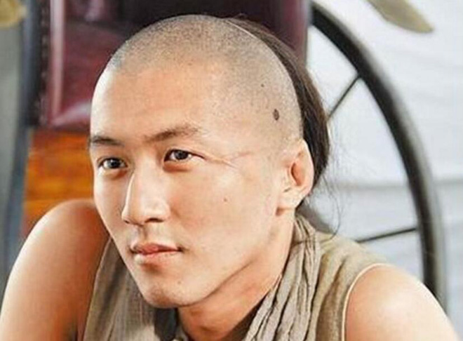 Vào năm 2009, Tạ Đình Phong phát hiện những dấu hiệu cho thấy bản thân bị ung thư da