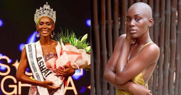 Thêm một mỹ nhân không có tóc đăng quang Hoa hậu Hoàn vũ Ghana 2022 
