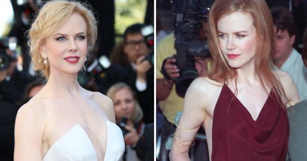 Thiên nga nước Úc Nicole Kidman thừa nhận không học hết cấp 3 vì không có khả năng học tập