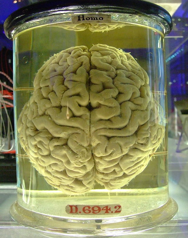 Nghe có vẻ giống như khoa học viễn tưởng, nhưng liệu khoa học thực tế có thể giữ cho một bộ não sống trong thùng không?