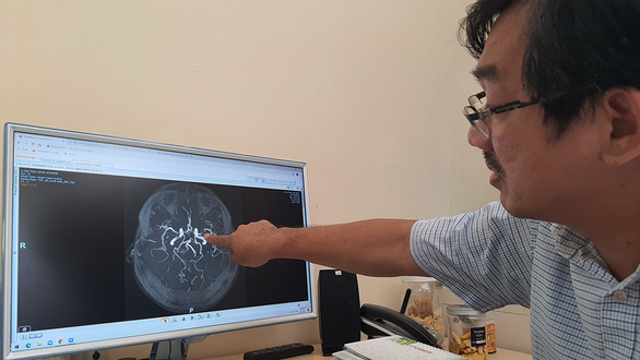 Bé 3 tuổi bị đột quỵ, bác sĩ chỉ ra nguyên nhân