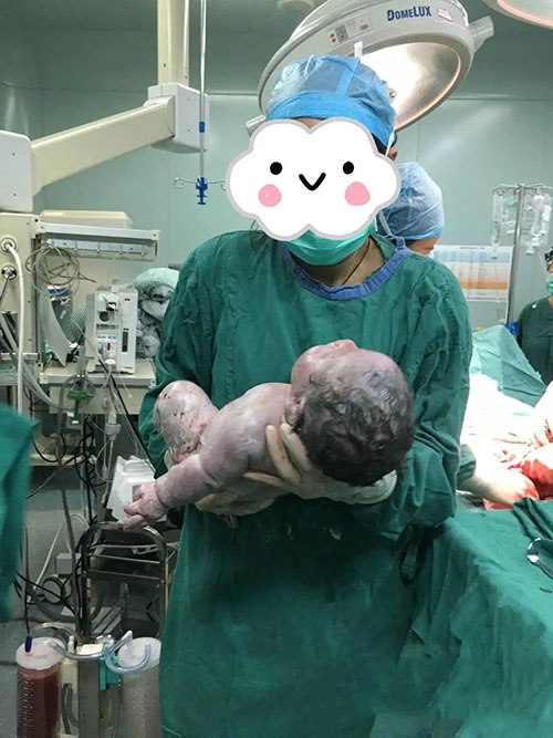 Con trai của chị Trần chào đời với cân nặng 5,25kg.