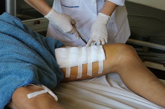 Quảng Ninh: Chàng trai bị bình rượu ngâm phát nổ làm đứt cơ đùi