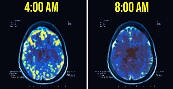 Hình ảnh sóng não hoạt động của người thức dậy lúc 4h sáng so với 8h sáng. (Ảnh: Commonwealth)