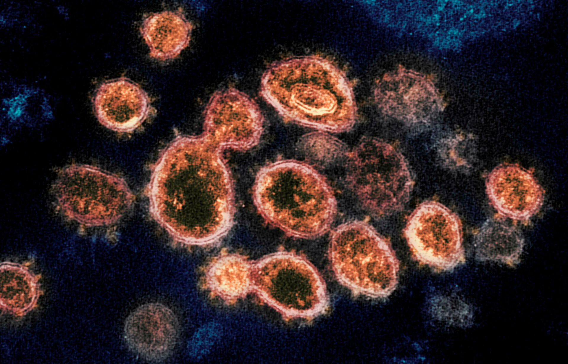 Chuyên gia Đức cho biết, xuất hiện biến chủng nCoV có khả năng kháng vaccine Pfizer, AstraZeneca - Ảnh minh họa