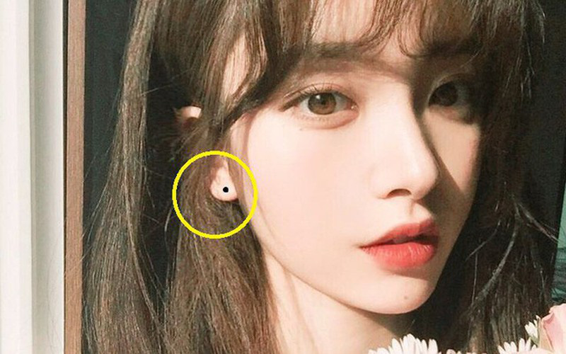 Có nốt ruồi ở  vị trí này là người giàu sang, trung vận cực vượng đừng dại tẩy đi