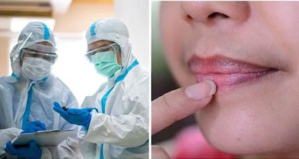 Dấu hiệu nhiễm Omicron đặc trưng trên da, môi và móng tay, nhận biết sớm sẽ tự cứu mình