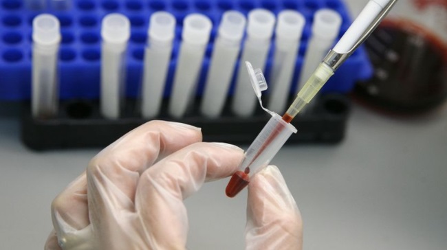 Lần đầu tiên trên thế giới có người khỏi HIV nhờ liệu pháp cấy tế bào gốc - Ảnh: Reuters
