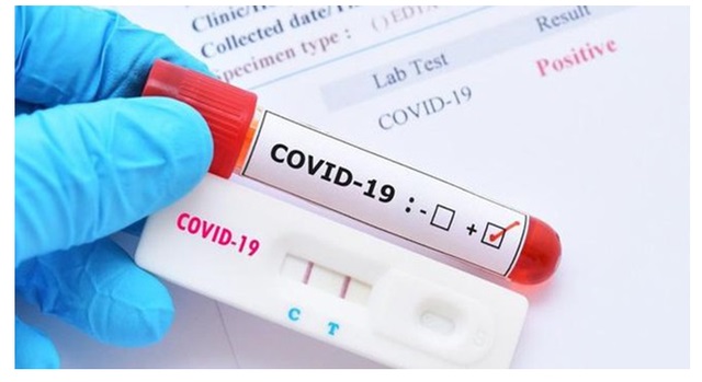 Bộ Y tế chấp nhận kết quả xét nghiệm nhanh thay cho kết quả xét nghiệm PCR - Ảnh Internet