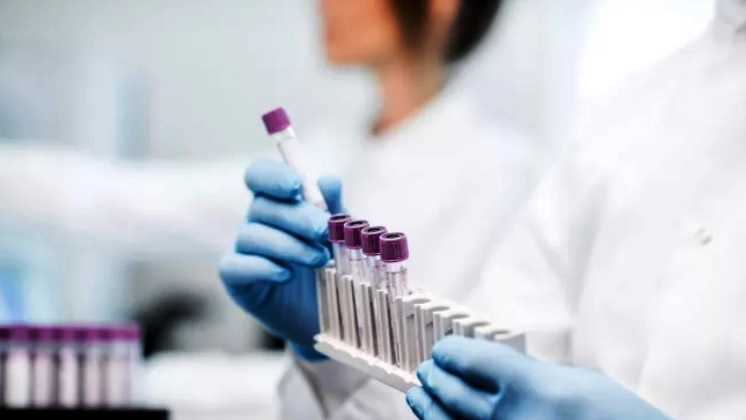 Giáo sư Đại học Mỹ cho biết xét nghiệm nước bọt có khả năng phát hiện Omicron hiệu quả hơn chọc mũi