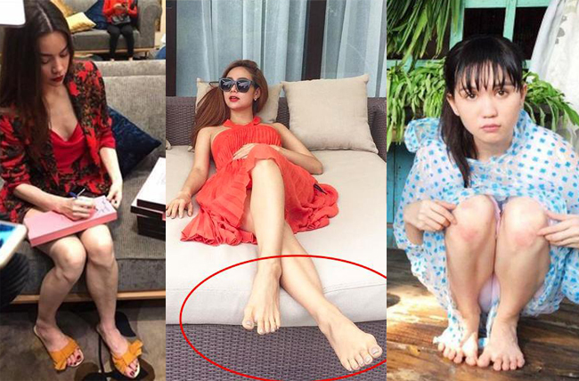 Nhiều mỹ nhân Việt cũng sở hữu đôi bàn chân thô và xương xẩu.