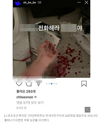 Hôn thê cũ của Park Yoochun khiến cộng đồng mạng xôn xao khi tự đăng tải bức ảnh cắt tay máu me.