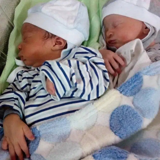 Một cặp song sinh ở Nigeria đã từng khiến bố mẹ lẫn bệnh viện sinh sản phải kinh ngạc ngay khi vừa chào đời.