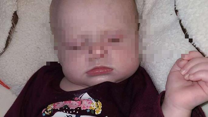 Bé Raelynn Larrison 4 tháng tuổi.