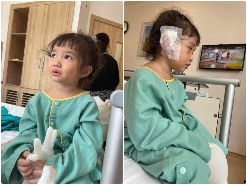 Con gái đầu 3 tuổi của Lê Dương Bảo Lâm vừa trải qua một cuộc tiểu phẫu ở tai.