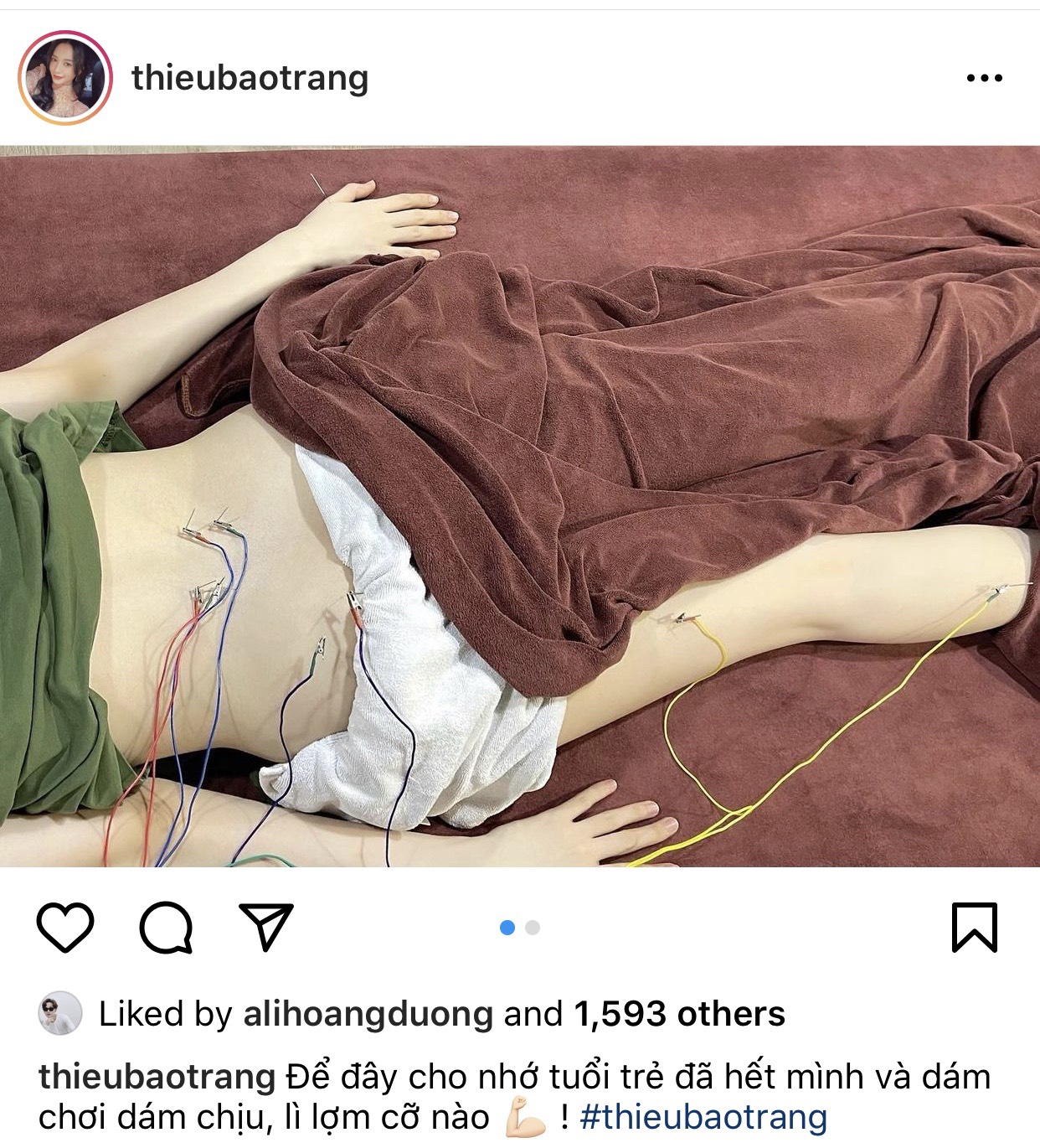 Thiều Bảo Trang đăng tải bức ảnh đang nằm trên giường, trên bụng chi chít những điện châm