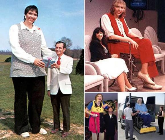 Người phụ nữ cao nhất thế giới do Guinness ghi nhận là Sandy Allen với chiều cao đến 2m31.