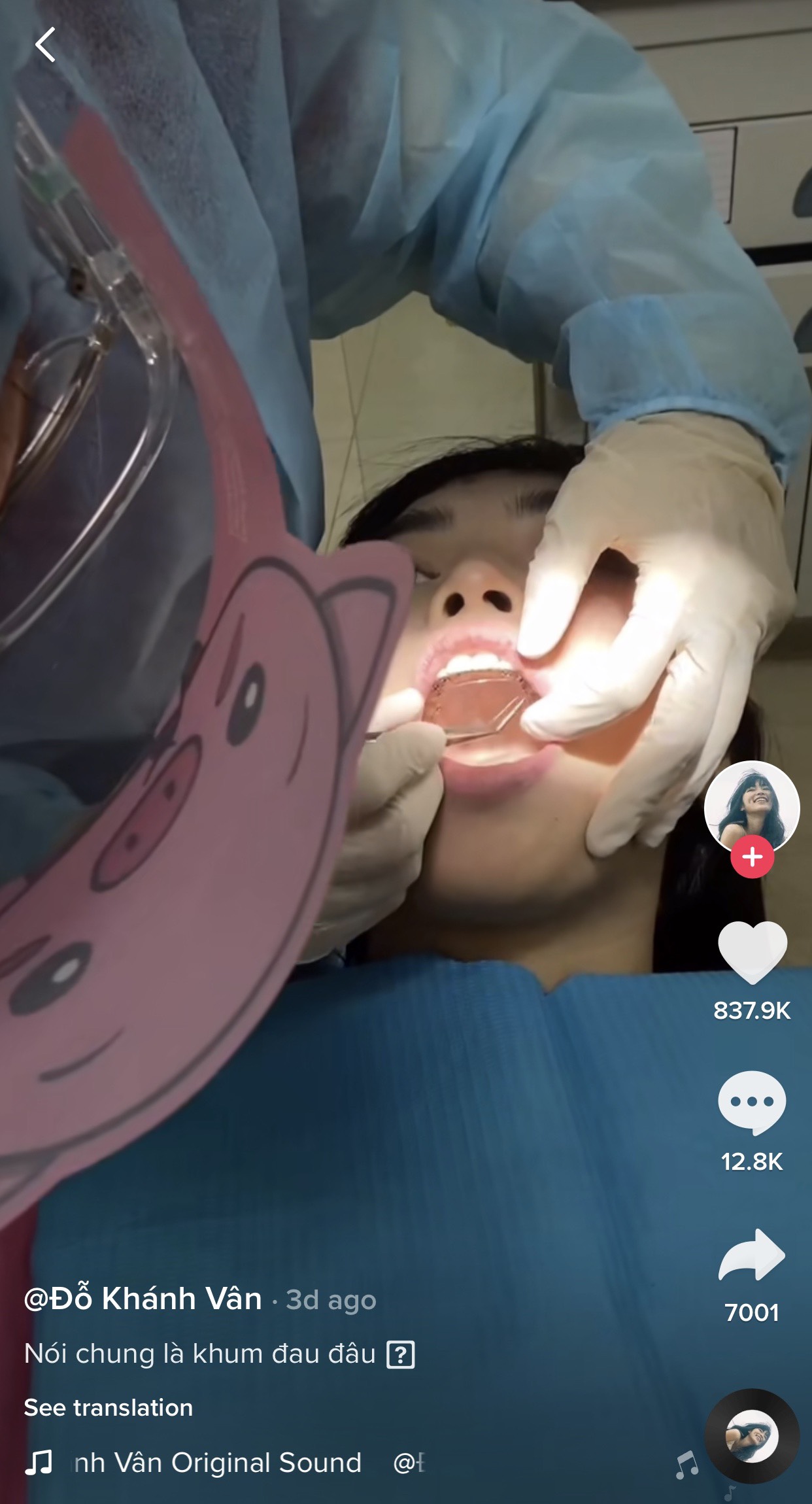 Khánh Vân vừa trải qua màn gắn răng implant sau một thời gian đeo niềng mặt trong