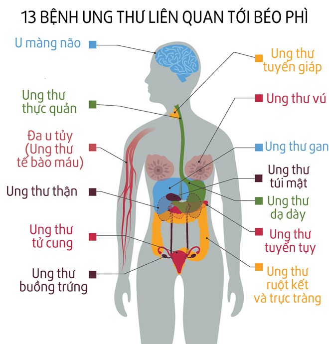 Người béo phì dễ mắc 13 loại ung thư - Ảnh 5