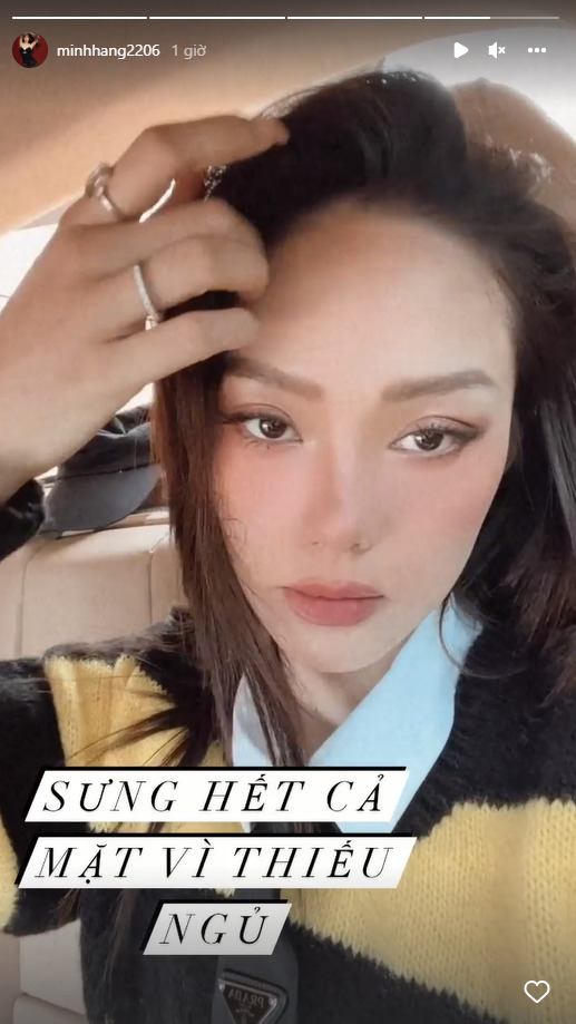 Minh Hằng lộ diện hốc hác, mặt sưng húp trước thềm đám cưới - Ảnh 2