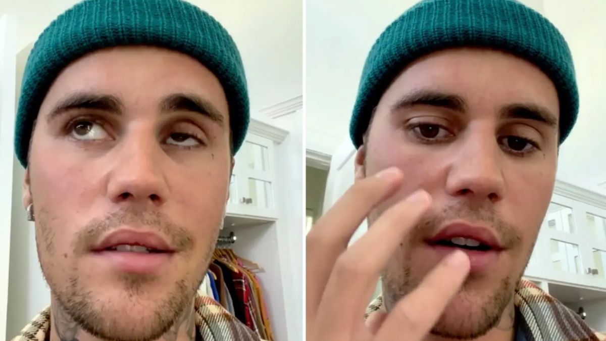 Justin Bieber hủy mọi show diễn vì bị liệt nửa mặt do nhiễm virus hiếm