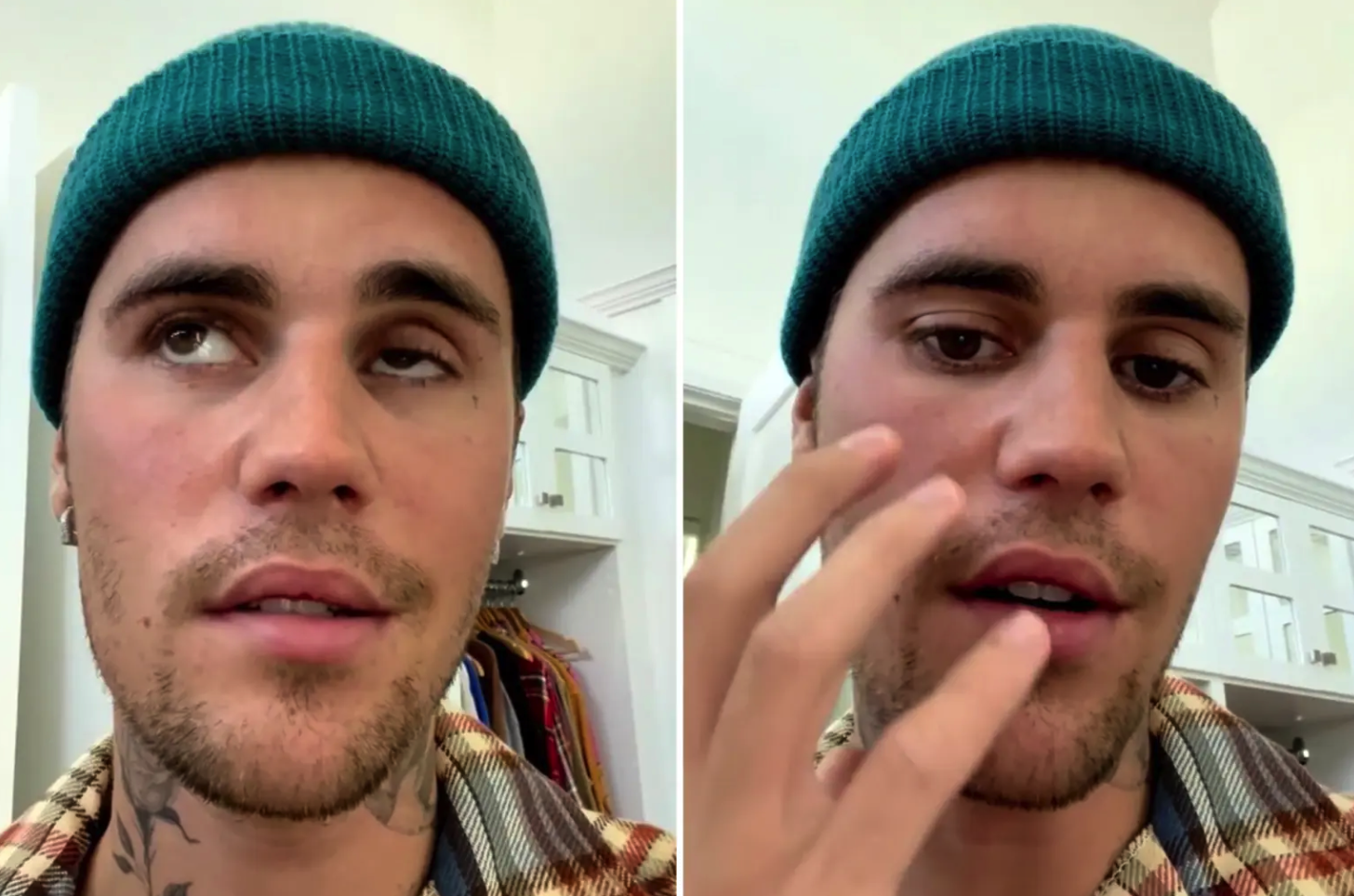 Justin Bieber hủy mọi show diễn vì bị liệt nửa mặt do nhiễm virus hiếm - Ảnh 1