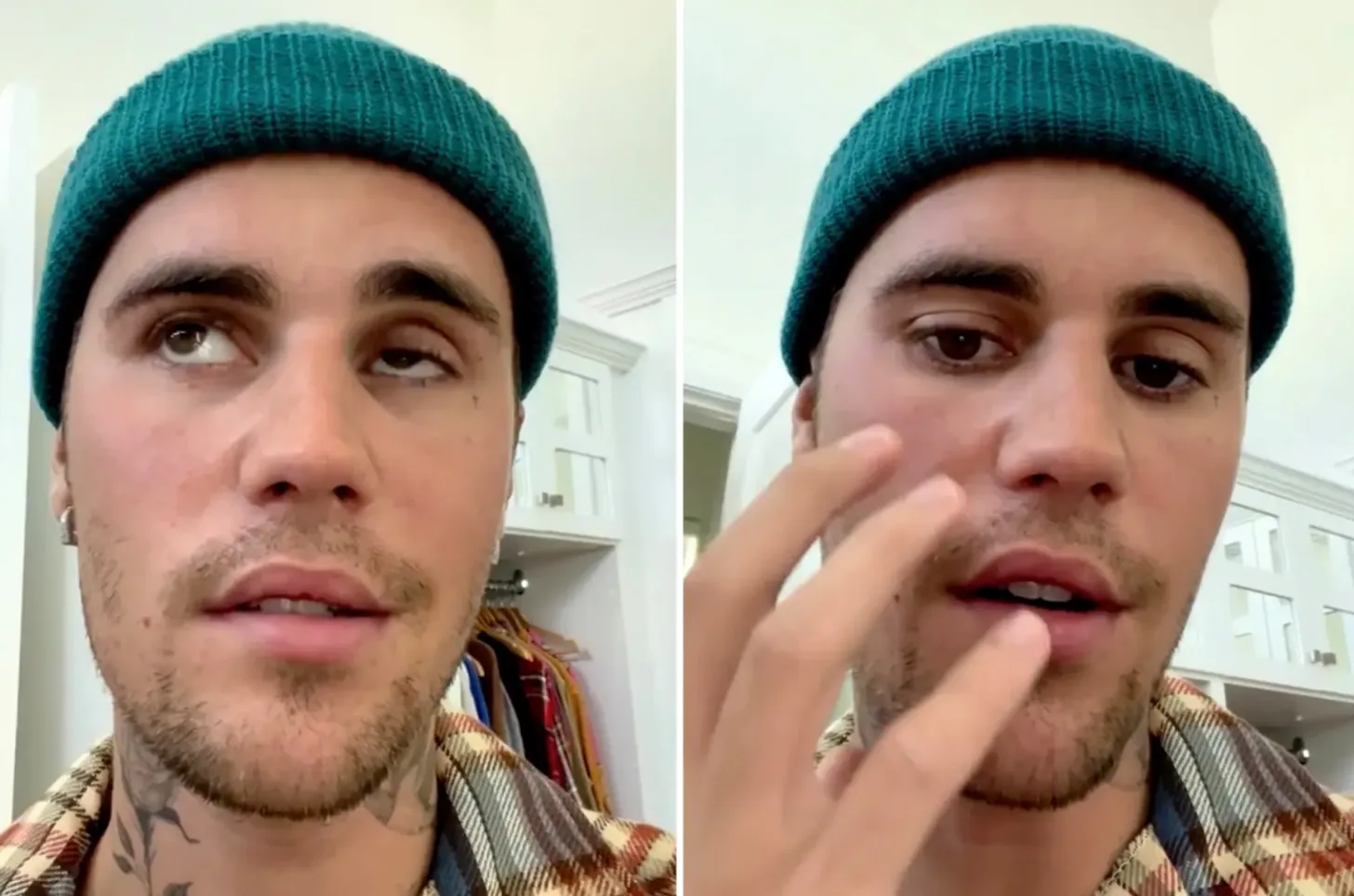 Justin Bieber hủy mọi show diễn vì bị liệt nửa mặt do nhiễm virus hiếm - Ảnh 1