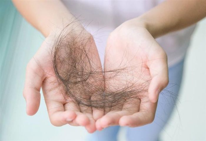 Vì sao người bệnh ung thư thường bị rụng tóc khi điều trị?
