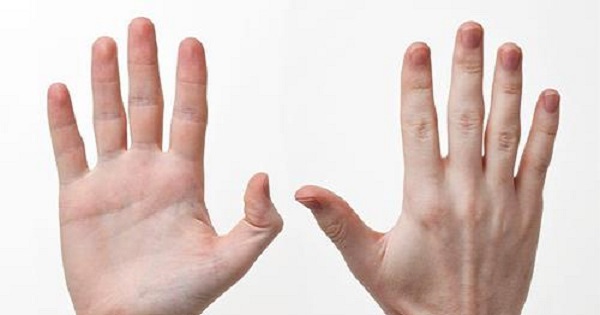 Nhân tướng học: Xem vận mệnh người có vết lõm dưới đốt ngón tay