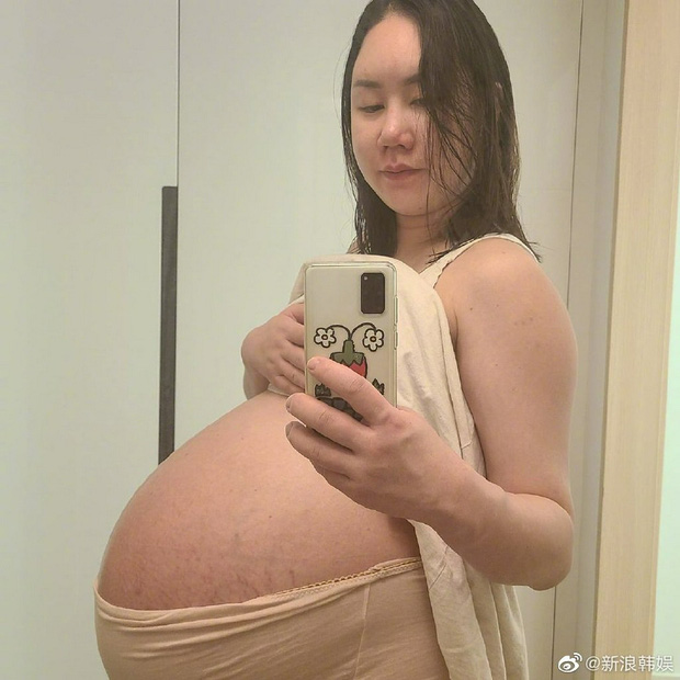 Nữ danh hài Hwang Shin Young mang thai ba, tăng 44kg, phải ngồi xe lăn  - Ảnh 1