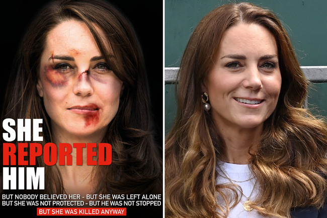  Hình ảnh Công nương Kate với gương mặt thâm đen như bị đánh gây phẫn nộ - Ảnh 1