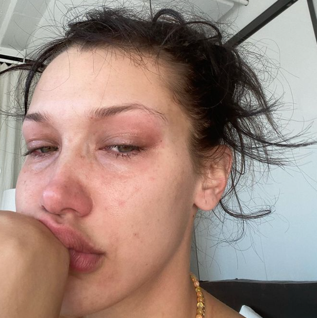 Nguyên nhân 'sốc' đằng sau việc Bella Hadid thường xuyên đăng ảnh khóc lóc lên mạng xã hội - Ảnh 1
