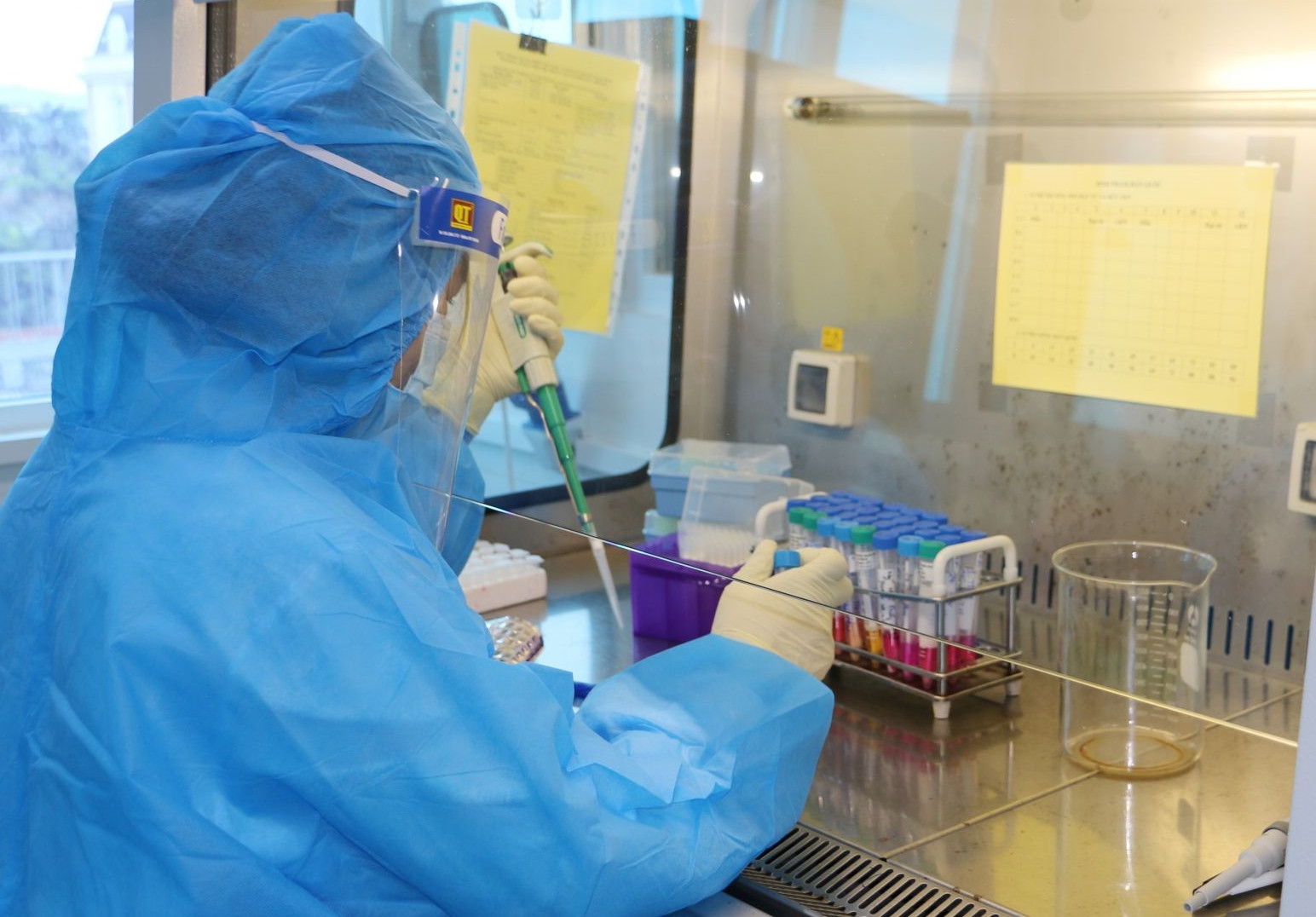 Việt Nam đã xuất hiện biến thể phụ BA.5 của Omicron - Ảnh 2