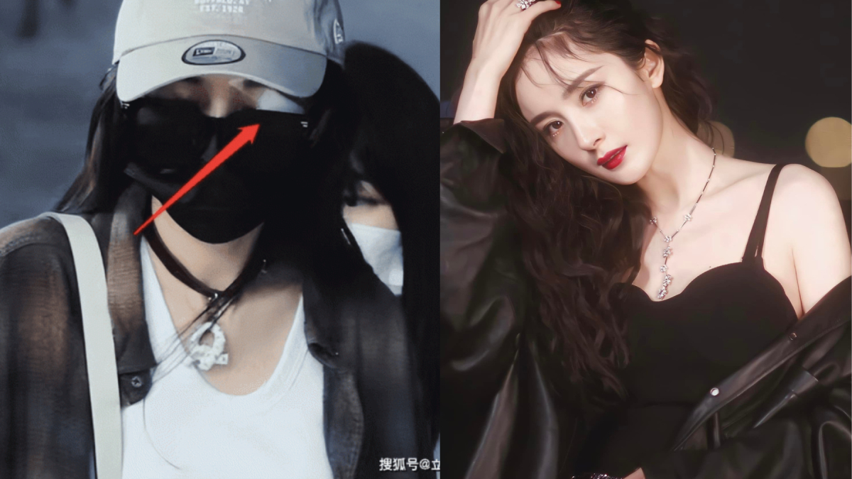 Dương Mịch đòi bồi thường 17 tỷ đồng sau sự cố rách khóe mắt