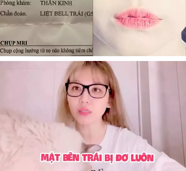 Hari Won gặp khó vì liệt nửa mặt, chụp ảnh 10 biểu cảm như 1 - Ảnh 2