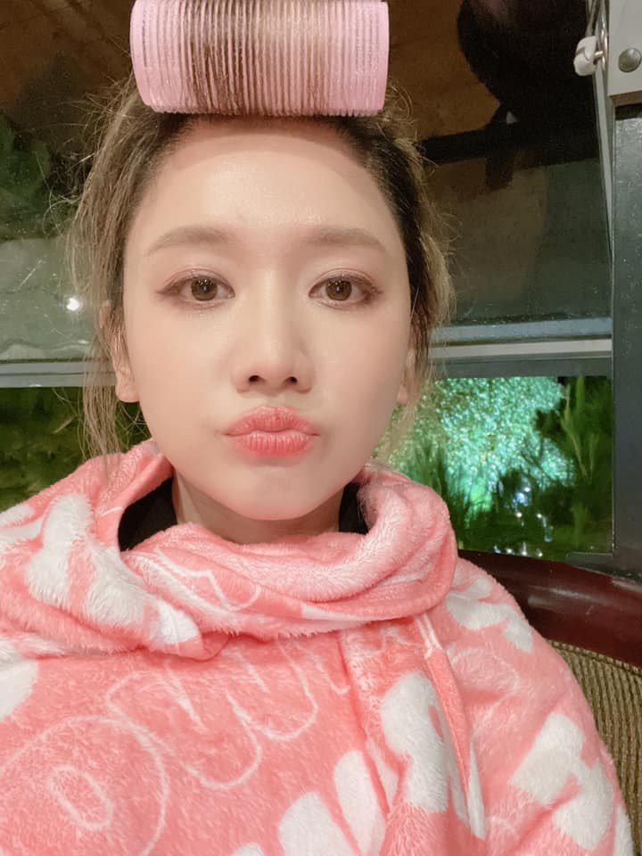 Hari Won sau 13 ngày bị liệt cơ mặt: “Mọi thứ đang dần ổn”  - Ảnh 2