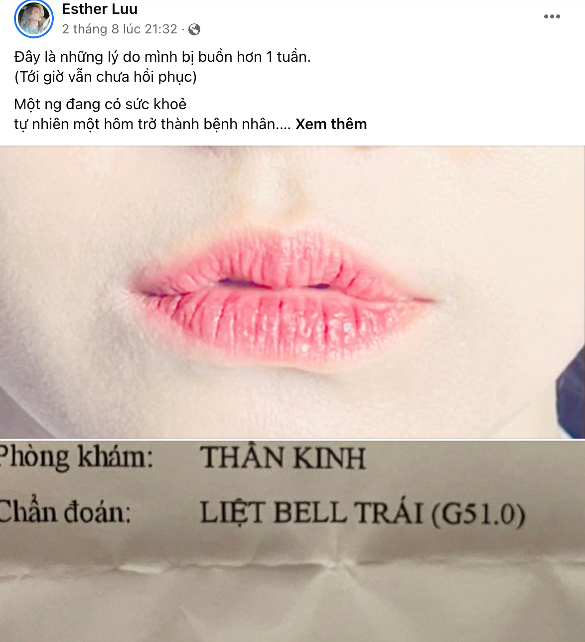 Hari Won sau 13 ngày bị liệt cơ mặt: “Mọi thứ đang dần ổn”  - Ảnh 4