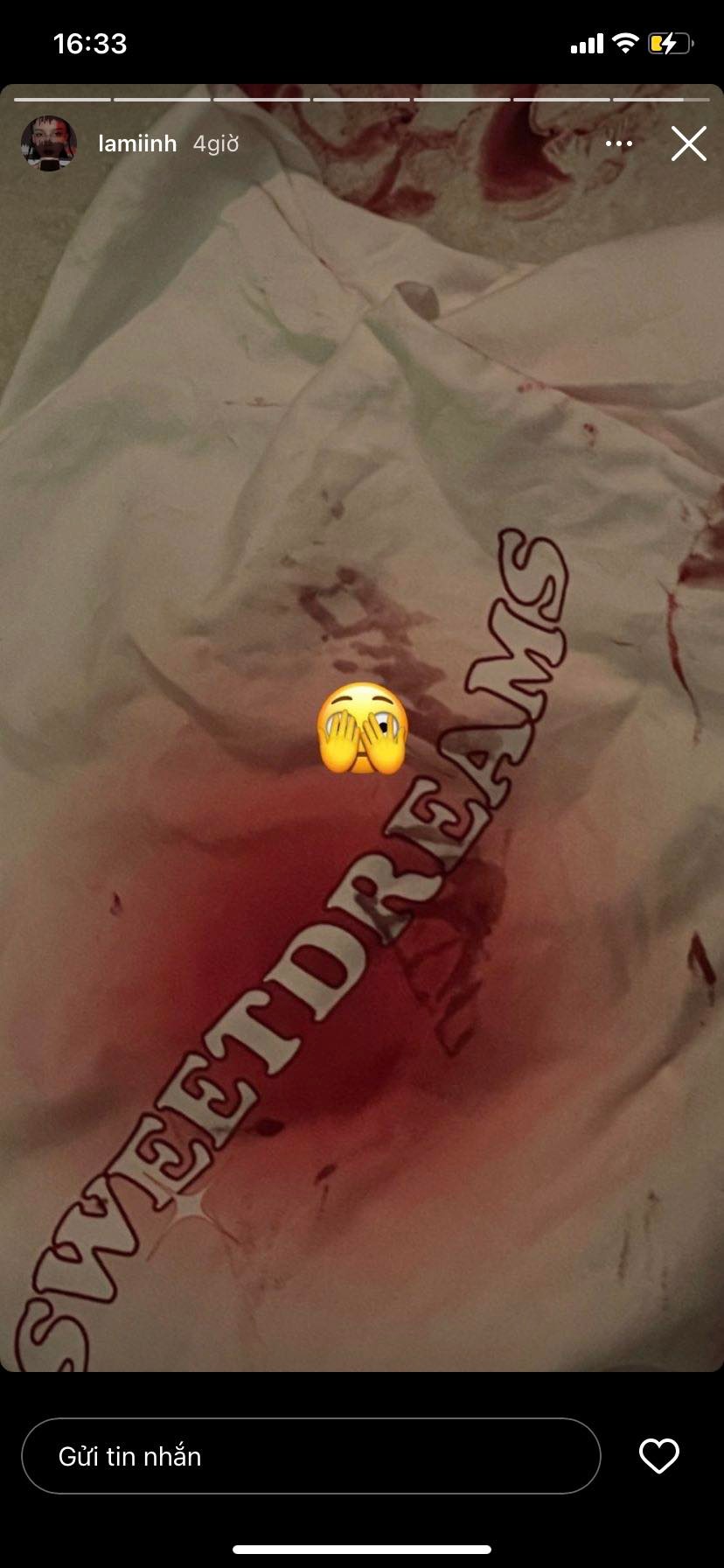 Vợ Decao phải điều trị tâm lý vì trầm cảm sau sinh, tiết lộ về xu hướng tự làm đau bản thân- Ảnh 2