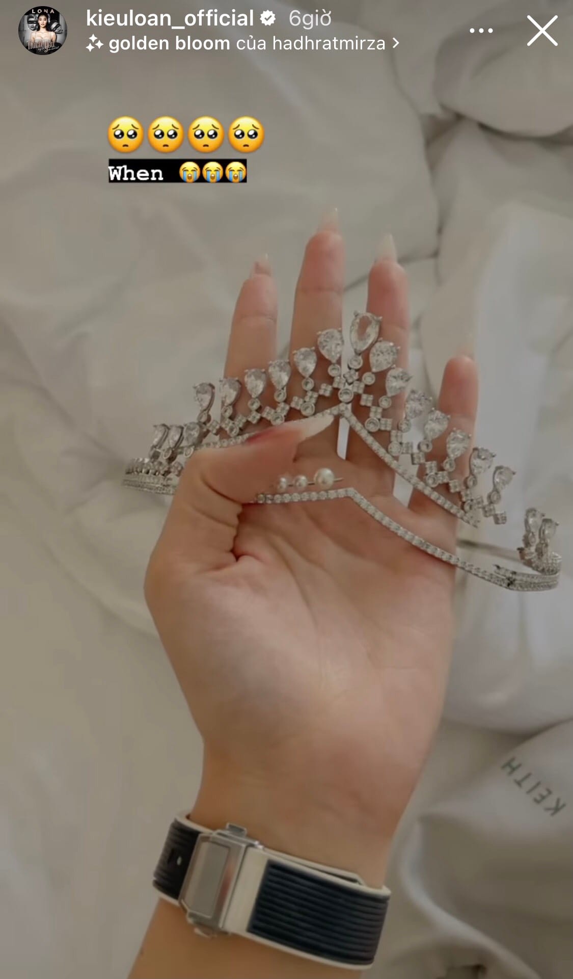 Á hậu Kiều Loan làm hỏng vương miện Tiara, gãy đôi và xuống cấp nghiêm trọng- Ảnh 3