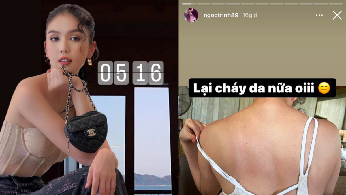 Đi resort 5 sao nhưng Ngọc Trinh dậy 5h sáng làm việc, cháy cả làn da thương hiệu